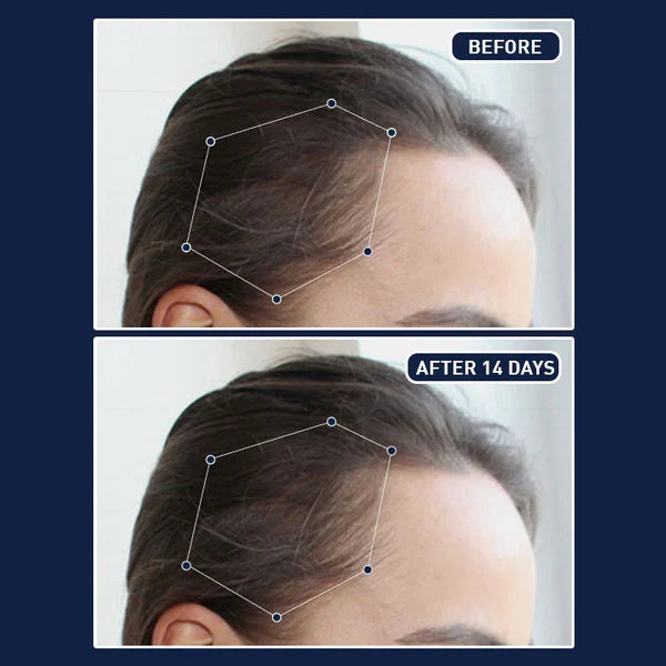 FEG™ Hair Growth Spray - بخاخ نمو الشعر