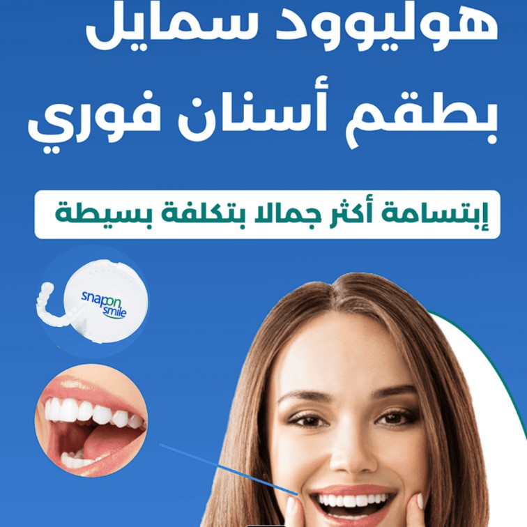 Snap-On Smile® – ابتسامة مثالية في ثوانٍ