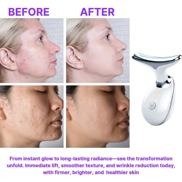 Original Intense Pulsed™ - 7 in 1 Led Facial Sculptor