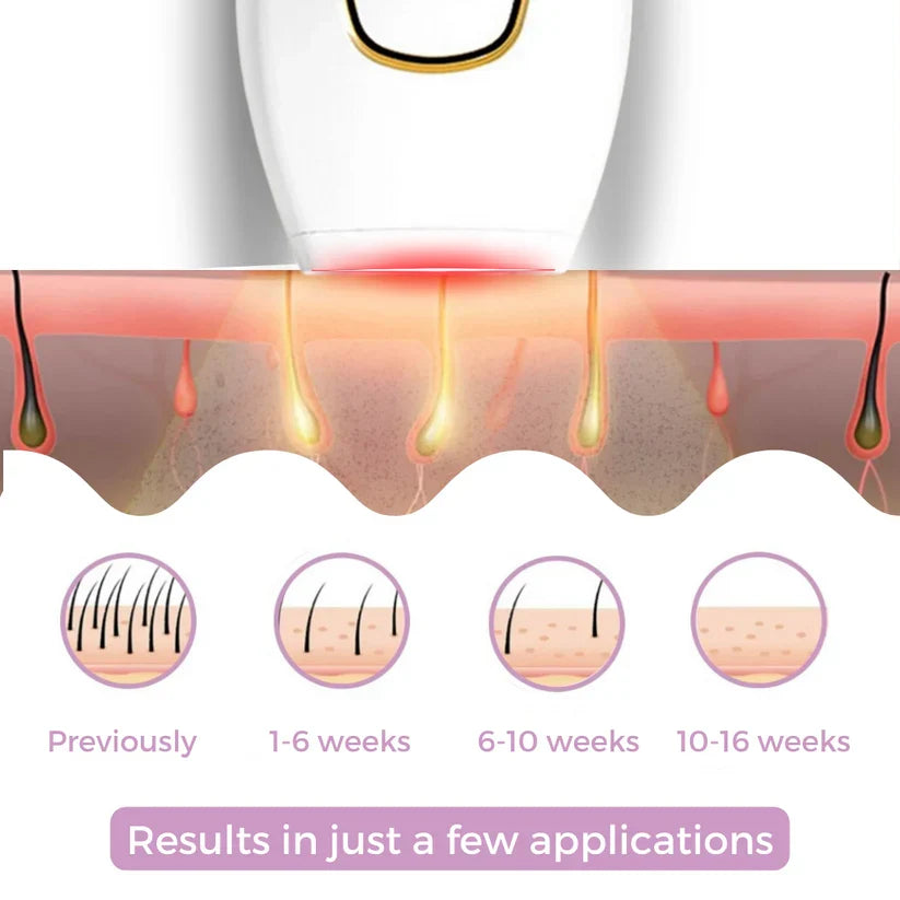 BeautyPlus IPL Hair Remover – Laser Hair Removal