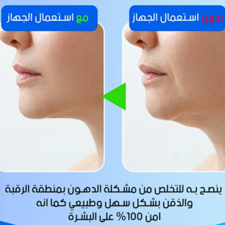 تنعيم ونحت البشرة، شد البشرة، إزالة التجاعيد والذقن المزدوجة