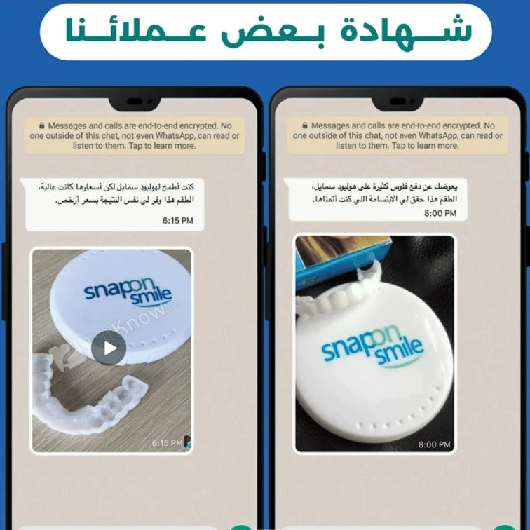 Snap-On Smile® – ابتسامة مثالية في ثوانٍ